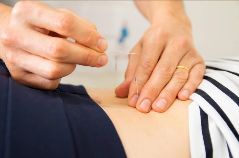 鍼施術